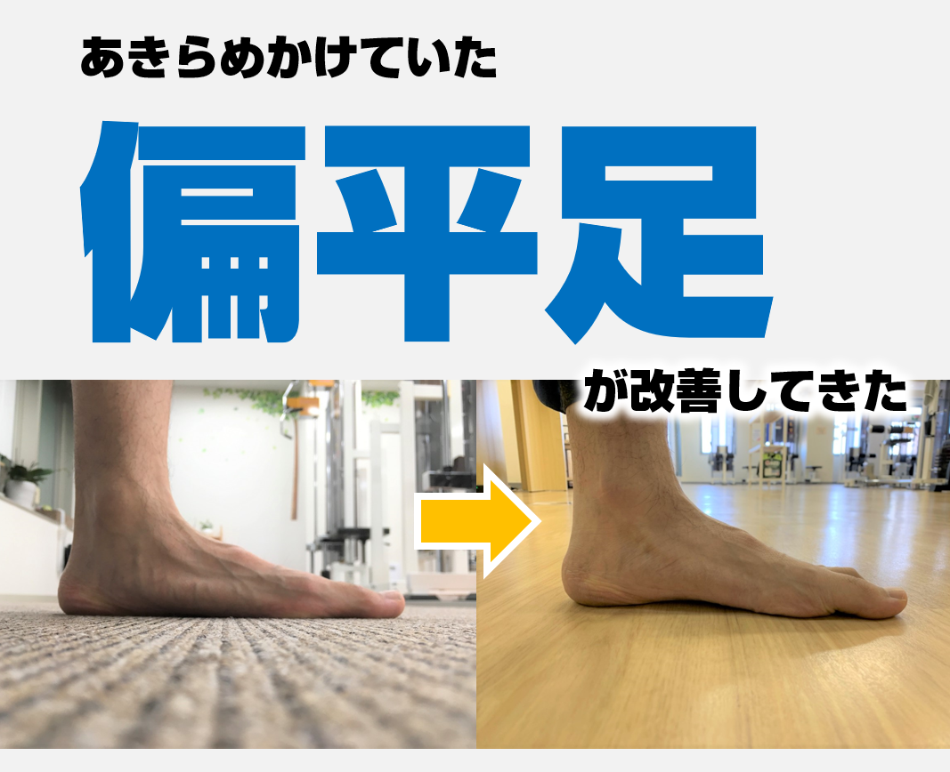 諦めていた偏平足が改善してきた-トレーニング5年目の成果【動画】 | ワールドウィング雲水グループ