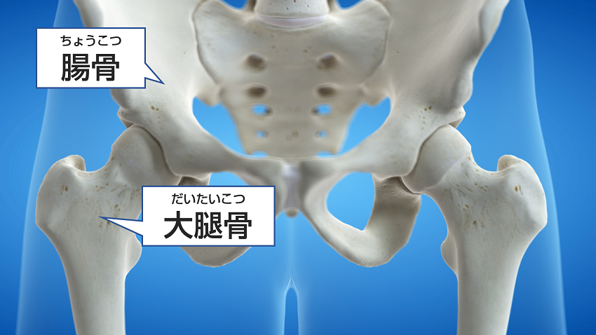 股関節の形状を示した画像