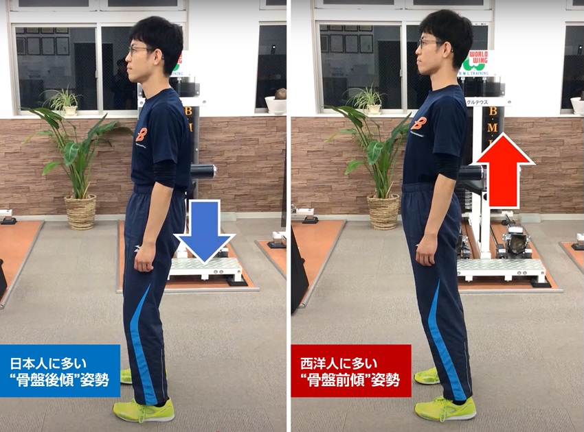 骨盤後傾、骨盤前傾による姿勢の違い