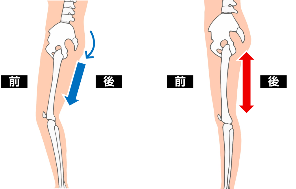 骨盤後傾姿勢と正常姿勢の比較