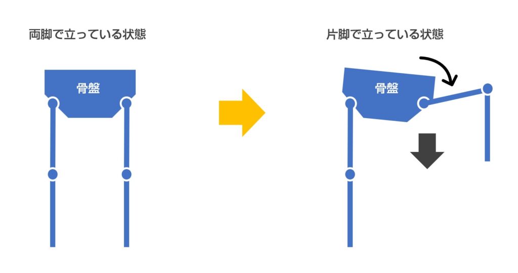 片脚立ちになった時の骨盤にかかる力のイメージ図